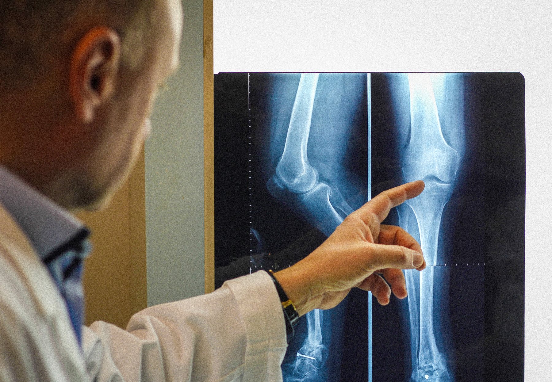 Dolore al ginocchio: le cause più frequenti e le cure